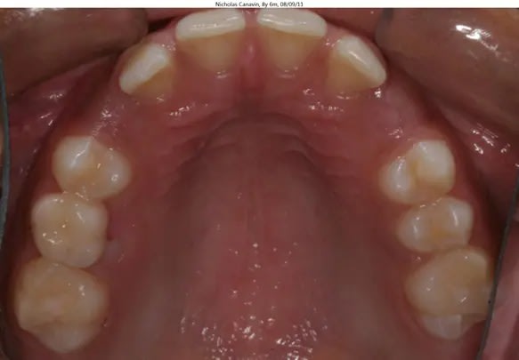 Tip head back, open wide and have a friend take the photo